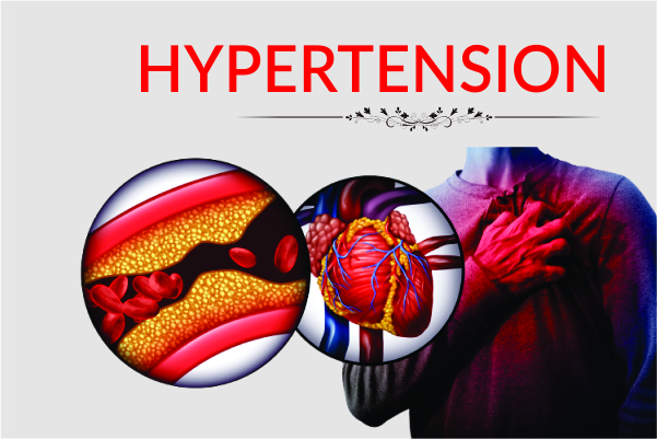 Hypertension