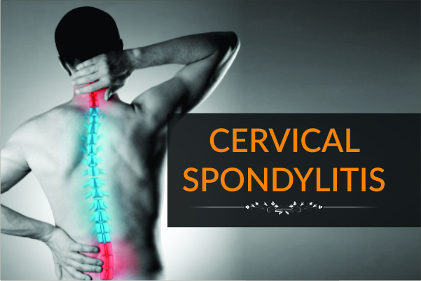 Cervical Spondylitis