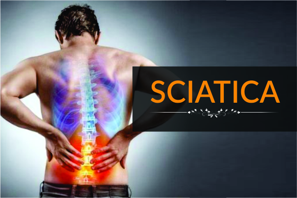 Sciatica