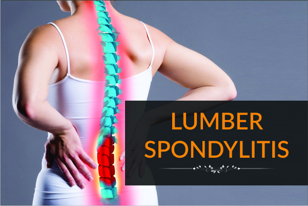 Lumber spondylitis