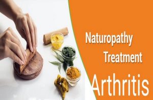 Naturopathy Treatments of Arthritis